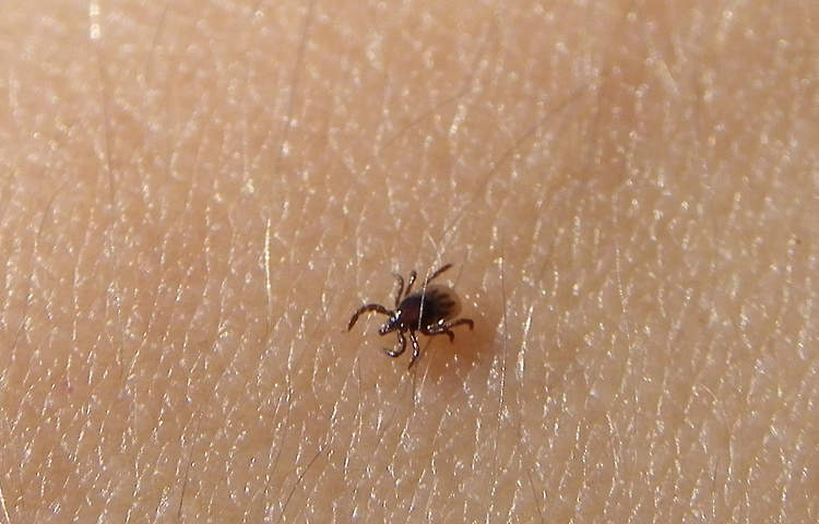 Tick on skin